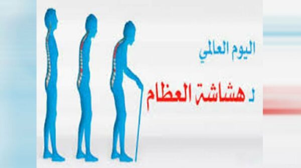 بوربوينت عن اليوم العالمي لهشاشة العظام
